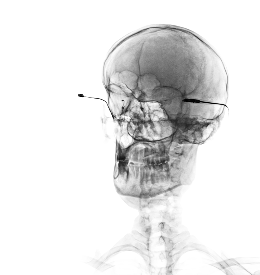 X-ray image